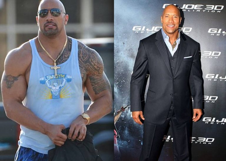 The Rock’s Before and After Plastic Surgery Photos are a Testament to